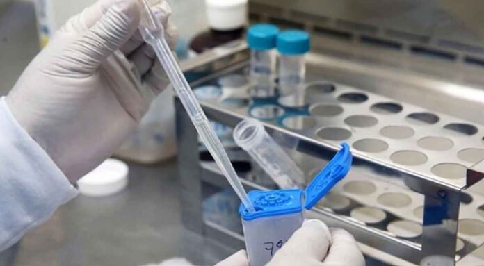 La tuberculosis no ha desaparecido. En 2024 provocó 1.23 millones de muertes a nivel global